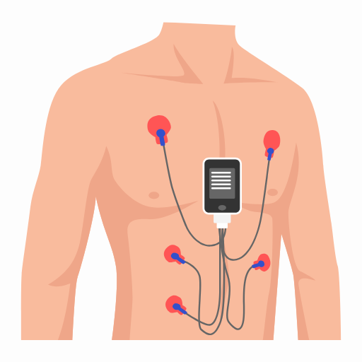 Holter Monitoring